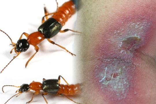 Cách phòng tránh kiến ba khoang, bảo vệ gia đình