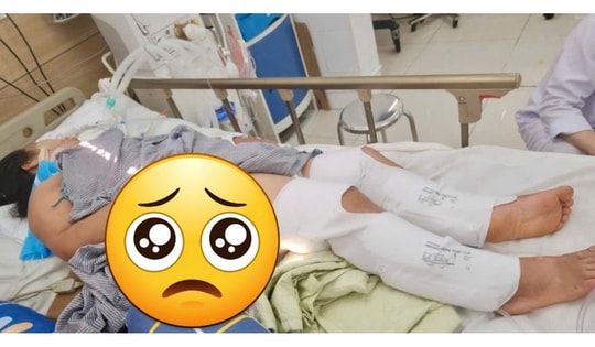 Gia tăng số ca bị rắn và động vật có độc cắn trong thời điểm bão Yagi đổ bộ