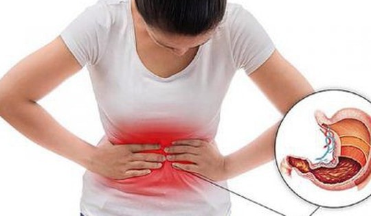 Đau dạ dày uống thuốc gì?