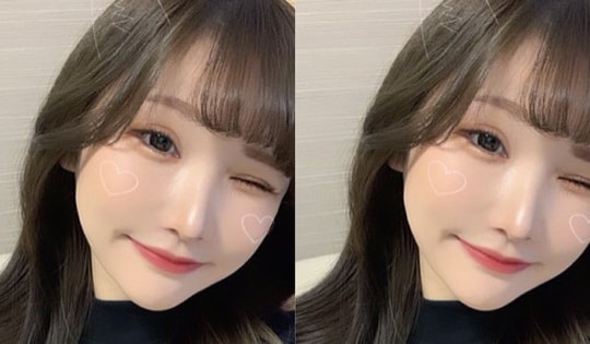 Cô gái chi hơn 3 tỷ để thẩm mỹ, giảm cân vì bị tình cũ chê, kết quả thế nào?