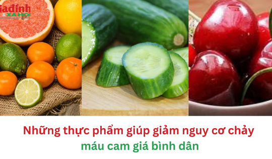 Những thực phẩm giúp giảm nguy cơ chảy máu cam giá bình dân