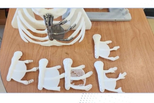 Đau ngực lâu không khỏi, đi khám phát hiện khối u lồng ngực