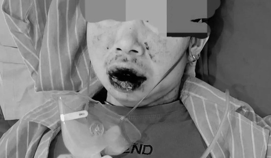 Mua thuốc trên mạng, người phụ nữ 66 tuổi ở Nghệ An tiền mất tật mang