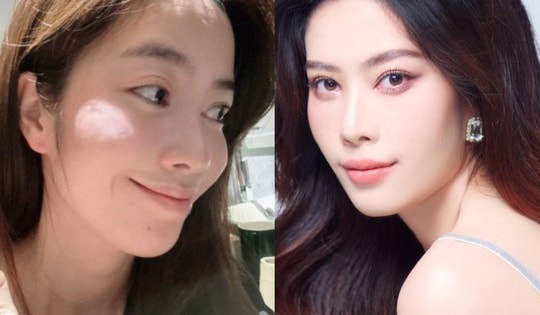 Ngoại hình đáng lo ngại của Nam Em