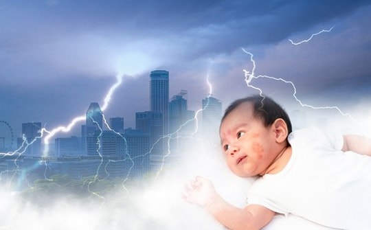 Giao mùa - hung thần với làn da nhạy cảm của trẻ và cách ứng phó