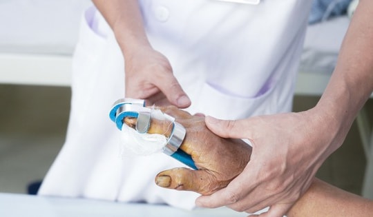 Người phụ nữ ở Phú Thọ gãy 3 đốt ngón tay khi rút sạc pin điện thoại