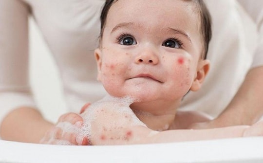 2 hung thủ trong sữa tắm có nguy cơ làm bé kích ứng, mẹ nên cẩn trọng