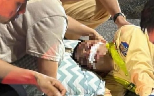 Nam sinh lớp 12 tông thiếu tá CSGT gãy chân