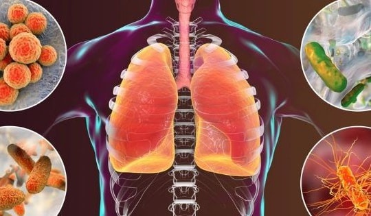 Các biểu hiện viêm phổi hay gặp khi giao mùa