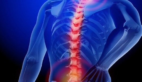 5 lý do gây thoát vị đĩa đệm ai cũng nên biết