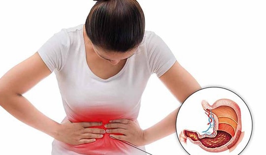 Polyp dạ dày có nguy cơ ung thư không?