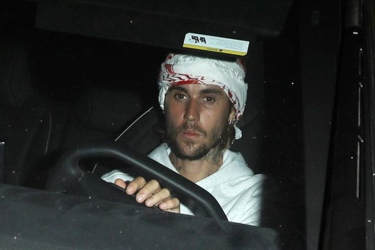 Justin Bieber xuất hiện mệt mỏi, hốc hác