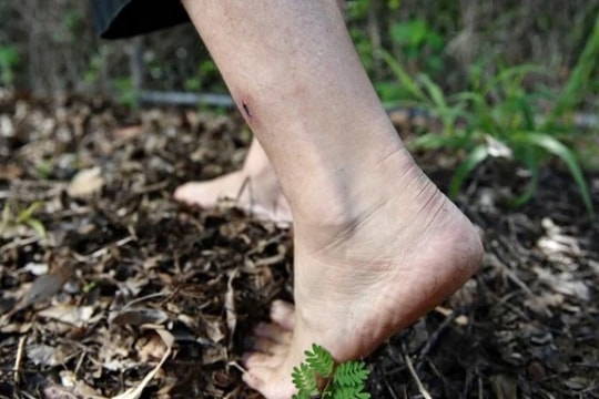 Giẫm phải đinh, người đàn ông nhiễm khuẩn uốn ván