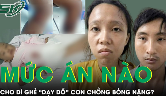 Sáng 7/10: Dì ghẻ 'dạy dỗ' con chồng bỏng nặng có thể đối mặt với tội danh cố ý gây thương tích?