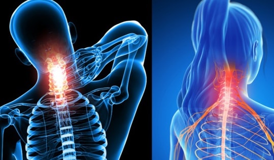 Bé 15 tuổi ở Hòa Bình đột ngột đau dữ dội, liệt tứ chi thừa nhận làm việc này trong lúc chơi game