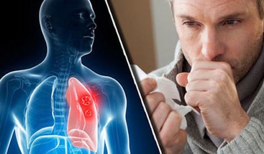 Người đàn ông 38 tuổi ở Phú Thọ đau họng, ho ra máu thừa nhận một sai lầm mà nhiều nam giới Việt mắc phải