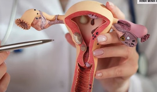 Dấu hiệu cảnh báo ung thư phụ khoa