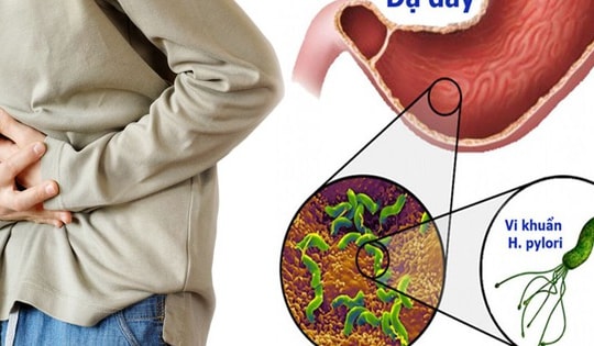 Bé 13 tuổi ói ra máu vì nhiễm khuẩn HP, khuyến cáo cha mẹ cần làm điều này để phòng bệnh cho trẻ