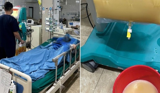 Người đàn ông 44 tuổi ở Tuyên Quang phải lọc máu trong đêm thừa nhận một sai lầm nhiều người Việt mắc phải