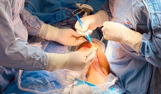 Ca phẫu thuật kéo dài 9 tiếng liên tục, giữ lại chân cho thanh niên 20 tuổi bị ung thư xương