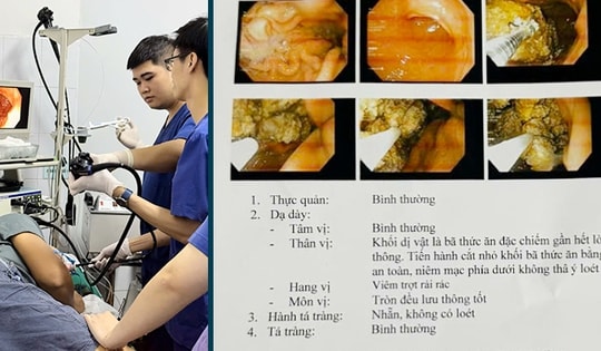 Người đàn ông 38 tuổi đau bụng dữ dội, nhập viện cấp cứu do thói quen ăn uống sai lầm nhiều người Việt mắc phải