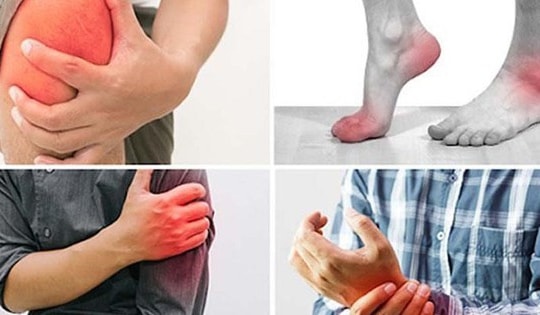 Đau xương khớp khi giao mùa, làm thế nào để giảm bớt triệu chứng?