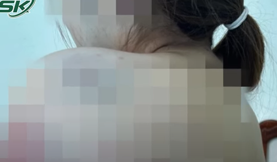 Làm rõ vụ người phụ nữ bị 'chồng hờ' nhốt trong phòng, 'trút đòn' suốt 13 giờ ở Kon Tum