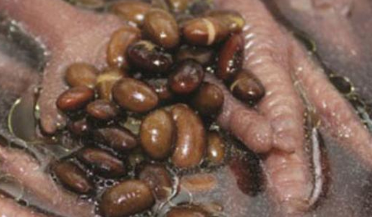 Tuyệt chiêu giúp ai cũng trẻ đẹp, khỏe mạnh và làn da săn chắc mùa khô hanh từ món chân gà hầm đỗ đen, nên ăn hàng tuần