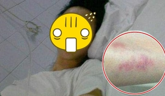 1 sao nữ hạng A bị cả đoàn phim đánh hội đồng gây sốc, biết lý do không ai bênh vực