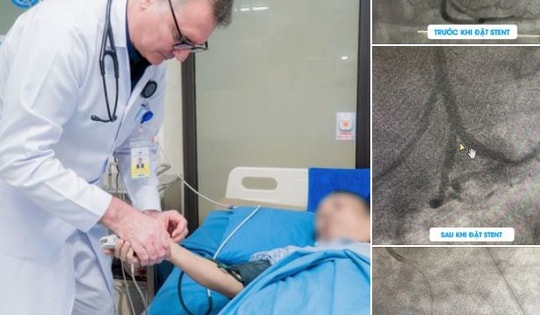 Người phụ nữ ở Phú Thọ bị nhồi máu cơ tim cấp có tiền sử mắc 4 bệnh lý này