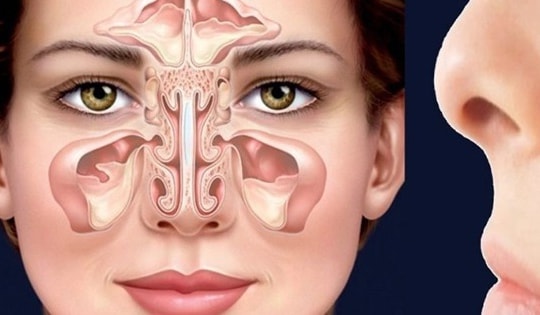 Cách đơn giản hạn chế viêm xoang trán mùa lạnh