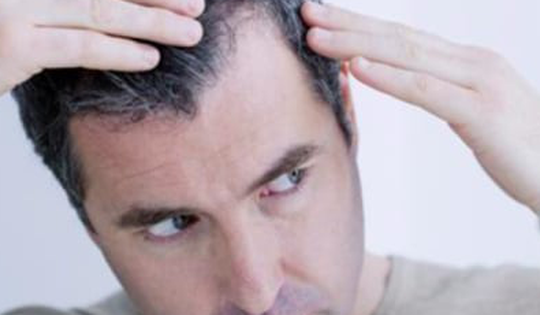 Nguyên nhân rụng tóc ở nam