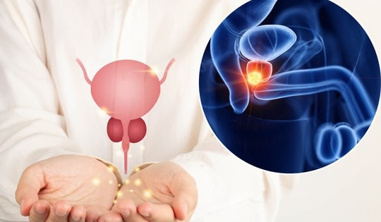 Khi nào nam giới nên tầm soát ung thư tuyến tiền liệt?