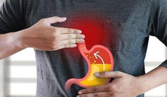 Ai dễ mắc bệnh trào ngược dạ dày thực quản?