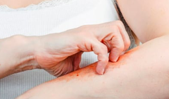 Cách khắc phục da khô, ngứa trong mùa đông