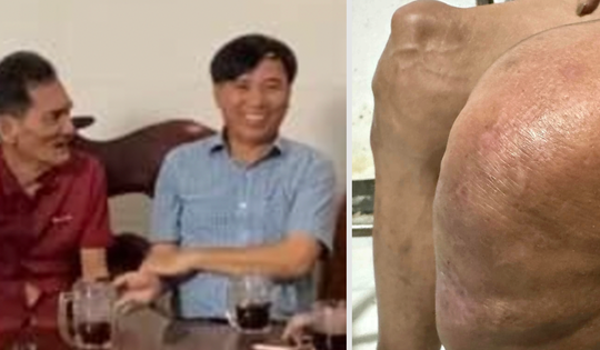 Thương Tín lên Sài Gòn khám bệnh, hình ảnh khiến fan xót xa