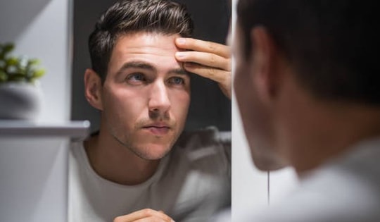 Soi gương mà thấy 2 dấu hiệu này, hãy nghĩ ngay đến cholesterol cao