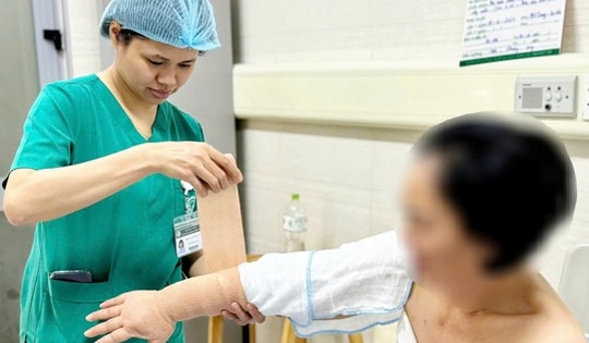 Thu nhỏ cánh tay cho bệnh nhân phù bạch mạch, bác sĩ chỉ ra các dấu hiệu dễ nhận biết bệnh