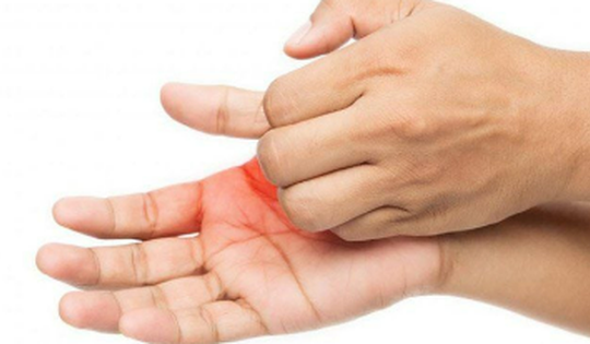 6 dấu hiệu bất thường cảnh báo thiếu canxi