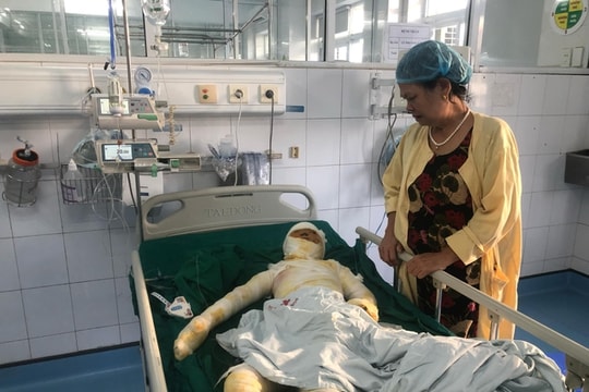 3 mẹ con cùng điều trị bỏng sau vụ hỏa hoạn, gia đình khánh kiệt cần sự giúp đỡ