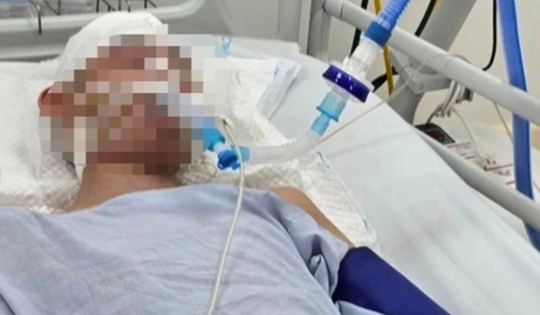 Tuyên phạt 4 năm 9 tháng tù với bị cáo đánh nam sinh lớp 8 tử vong