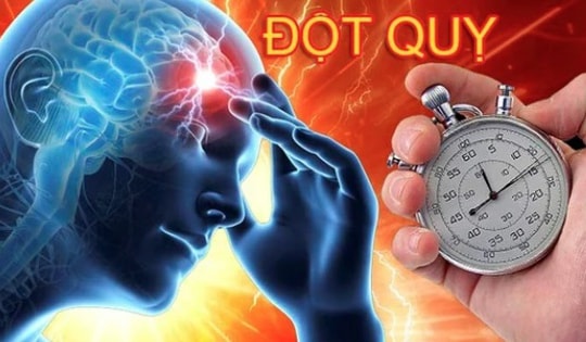 5 nhóm người có nguy cơ đột quỵ cao, ai có dấu hiệu này phải cảnh giác