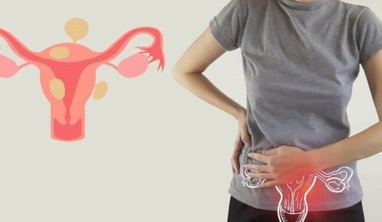 Cách duy trì đời sống tình dục lành mạnh khi bị lạc nội mạc tử cung