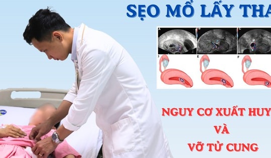 Sản phụ 40 tuổi ở Củ Chi nhập viện gấp vì thai bám ở sẹo mổ nguy hiểm