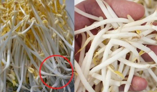 Ăn phải giá đỗ ngâm hóa chất nguy hiểm thế nào đến sức khỏe?