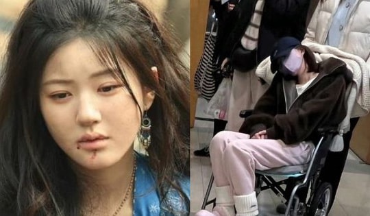 Phẫn nộ lời đáp trả của công ty quản lý sau khi bị Triệu Lộ Tư tố đánh đập, bóc lột đến trầm cảm