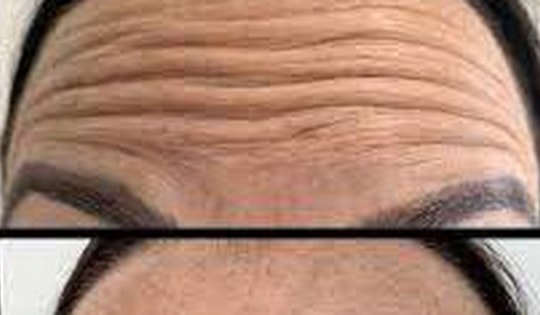 14 thực phẩm 'thần dược' ngăn ngừa nếp nhăn cực tốt, chị em lưu ý