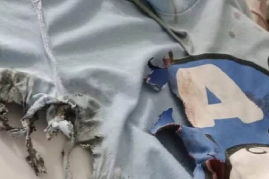 Bé trai 1 tuổi bị pháo hoa nổ gây chấn thương phổi: Cảnh sát khoanh vùng 2 nghi phạm