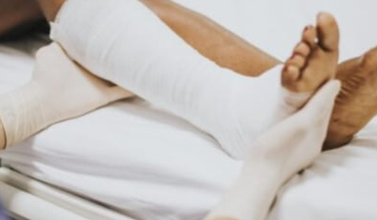 Cách sơ cứu khi bị gãy xương nhanh chóng và an toàn nhất