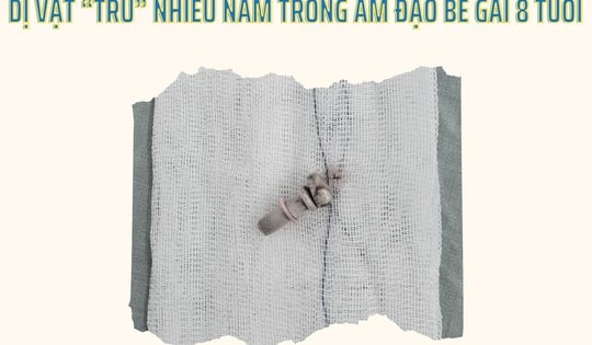 Bất ngờ phát hiện dị vật trú nhiều năm trong vùng kín bé gái 9 tuổi